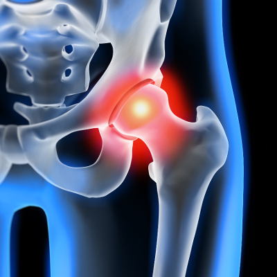 aliterme-controllo-osteoporosi-servizi