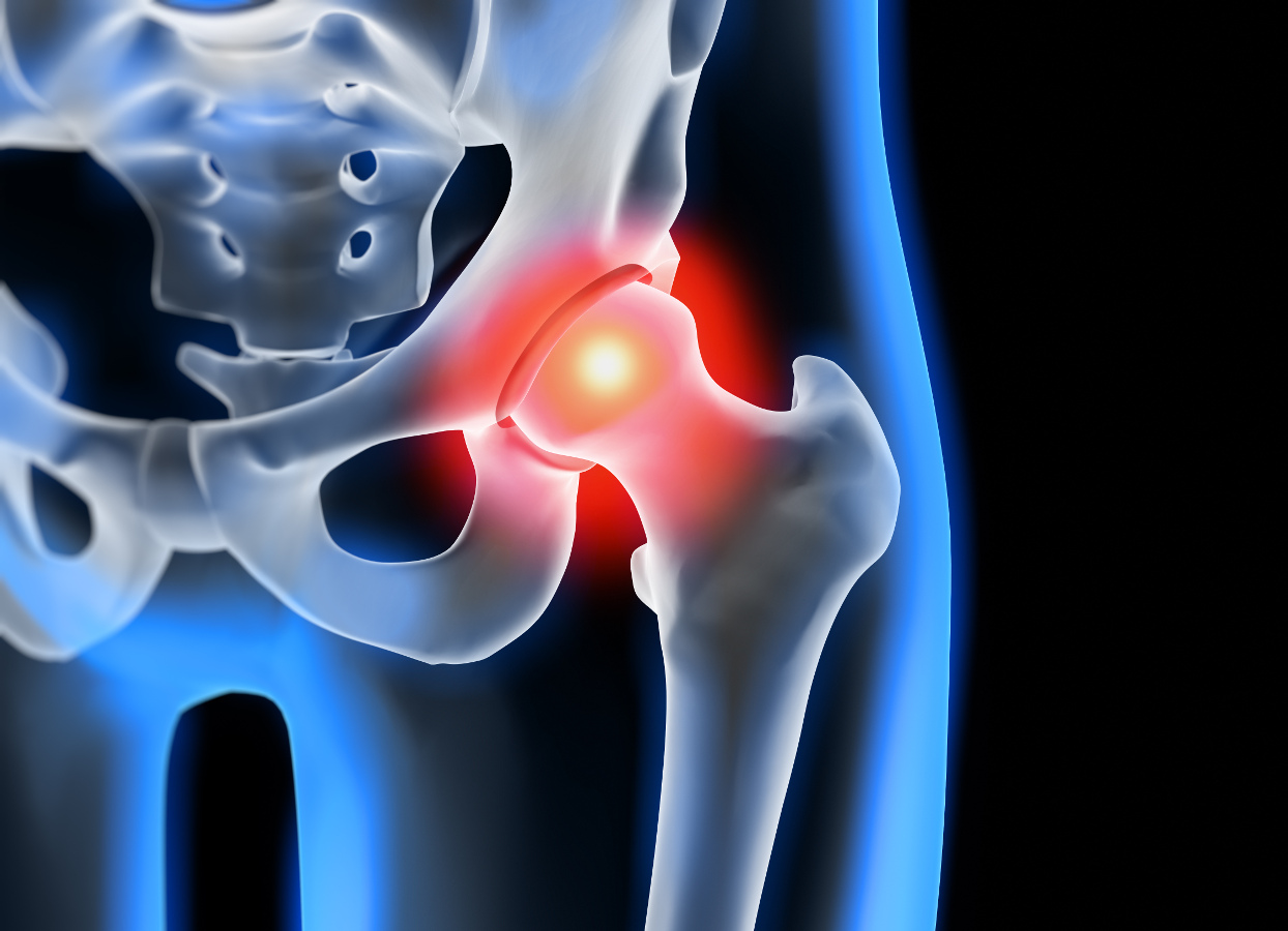 aliterme-controllo-osteoporosi